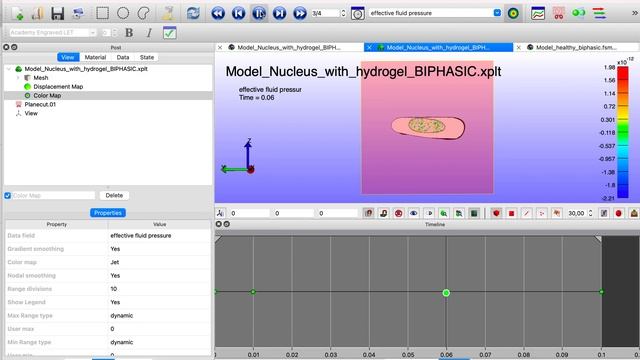 IVD with PEG/HA hydrogel injection смотреть онлайн