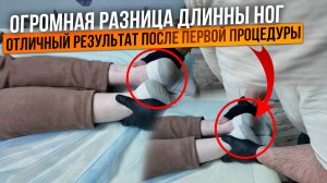 Огромная разница в длине ног(( Исправимо!!