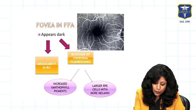 Ophthalmology Rewind| Fundus Fluorescein Angiography| NEET PG Preparation| смотреть онлайн