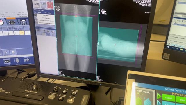 КТ почек и надпочечников с контрастом, обучение.mp4 смотреть онлайн