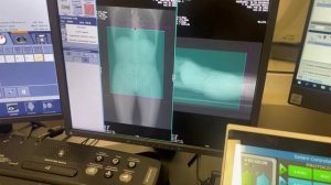 КТ почек и надпочечников с контрастом, обучение.mp4