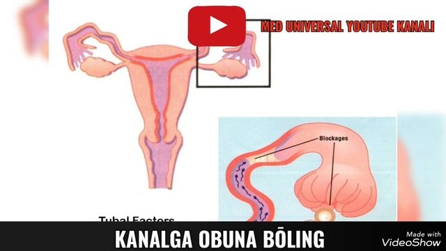 YETILMAGAN BACHADON HAQIDA MA'LUMOT. SHAKLLANMAGAN BACHADON HAQIDA MA'LUMOT