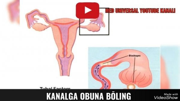 YETILMAGAN BACHADON HAQIDA MA'LUMOT. SHAKLLANMAGAN BACHADON HAQIDA MA'LUMOT