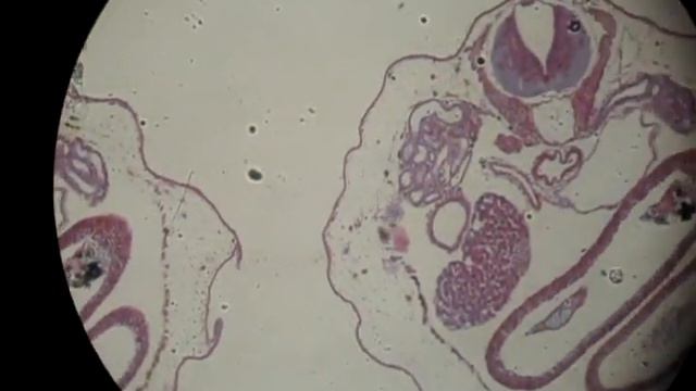 10mm. Frog Embryo serial x.s. (cross section) смотреть онлайн