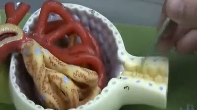 NEPHRoN-MEDical VEDios смотреть онлайн