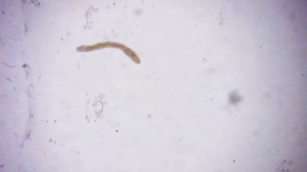 В поисках гидры: обитатели московских водоёмов