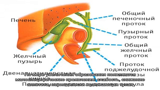 Рак желчного пузыря смотреть онлайн
