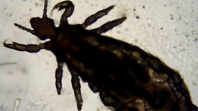 Pediculus humanus sp corporis. смотреть онлайн