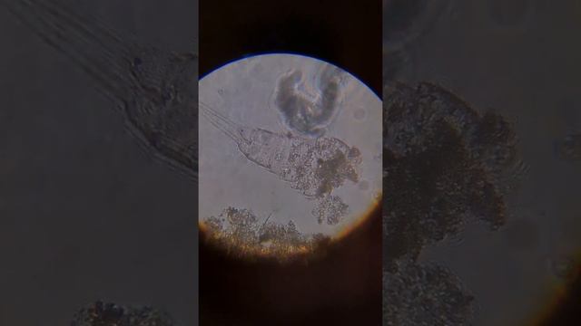 A protozoa inside the exoskeleton of a copepod #amateurmicroscopy смотреть онлайн