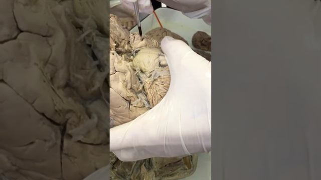 ЦНС 6 смотреть онлайн