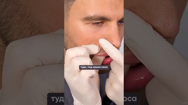 Первые признаки носогубной складки #лицо #красота #морщины