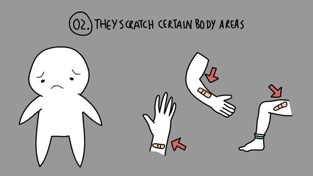 5 Неочевидных Признаков Самоповреждения СЕЛФХАРМ смотреть онлайн