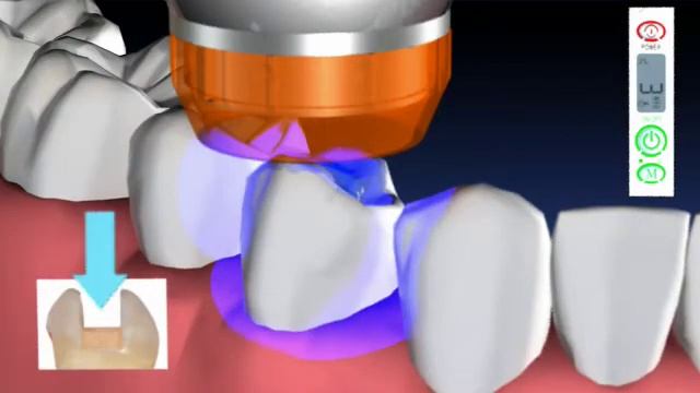 DentLight FUSION dental curing light смотреть онлайн