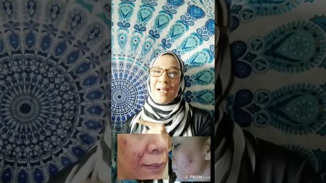 Nurraysa Collagen Soap смотреть онлайн