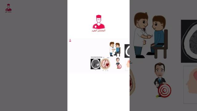 من طرق تشحيص سكته الدماغ