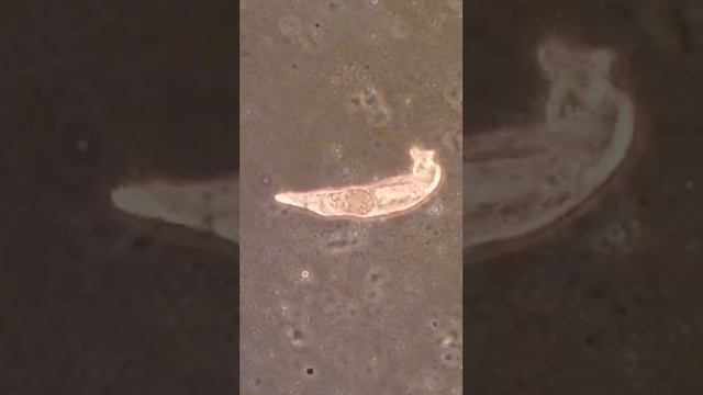 Monogenean forming/releasing egg смотреть онлайн