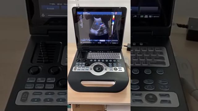 YJ-X3800 Full Digital Color Doppler System смотреть онлайн