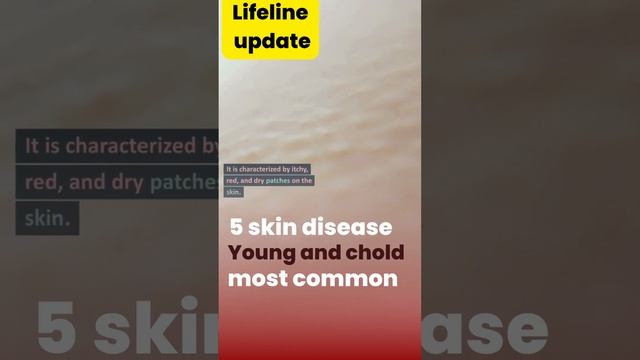 5 common skin disease in adult | skin disease in adult #skincare смотреть онлайн