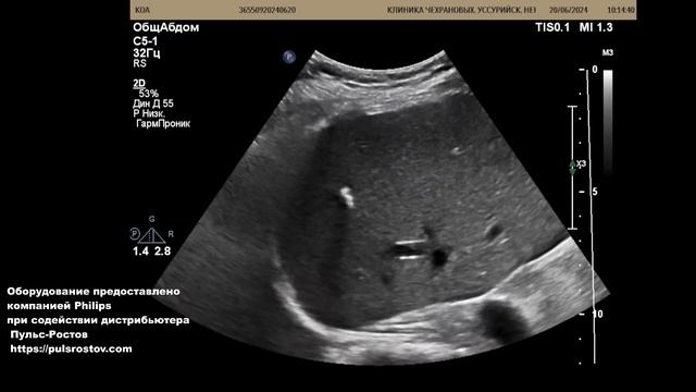 УЗИ органов брюшной полости