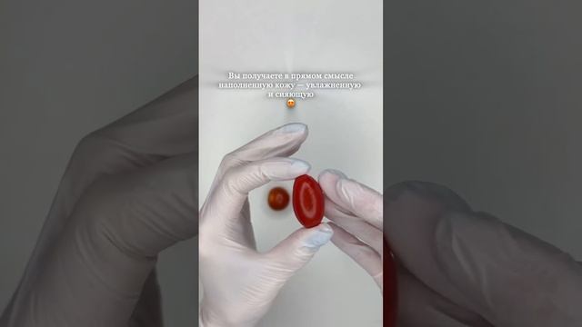 Как работает биоревитализация