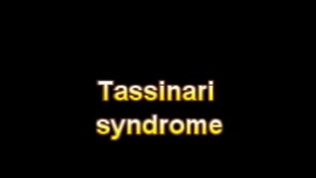 What Is The Definition Of Tassinari syndrome смотреть онлайн