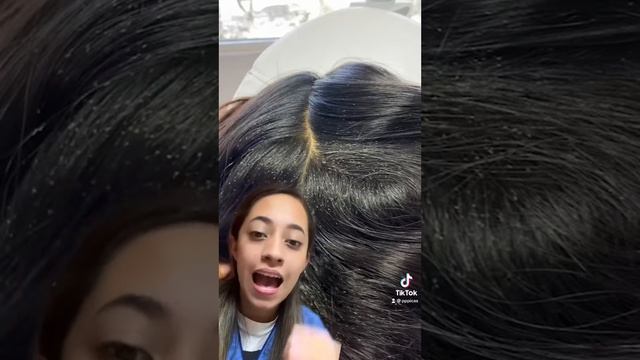 Mi peor caso de piojos😩😭 pp picas смотреть онлайн