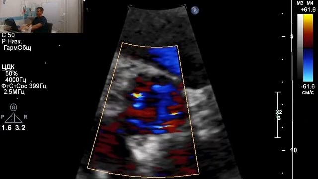 ЭХОКГ ( УЗИ сердца) полный протокол с описанием.