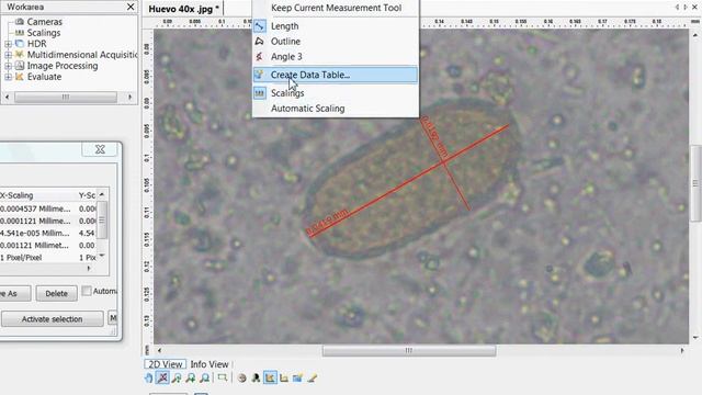 Paracapillaria philippinensis - medición de huevos - Piura смотреть онлайн