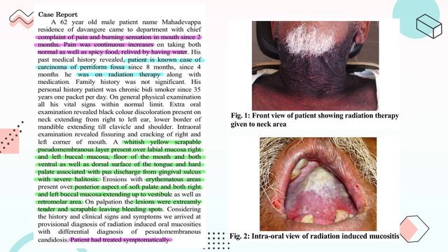 Oral Mucositis Care смотреть онлайн