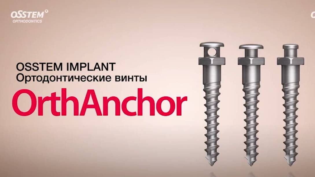 Ортодонтическиие винты OrthAnchor смотреть онлайн
