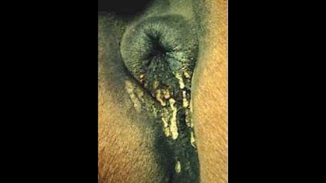 OXYURIS EQUI - PARASITLOGIA VETERINARIA смотреть онлайн