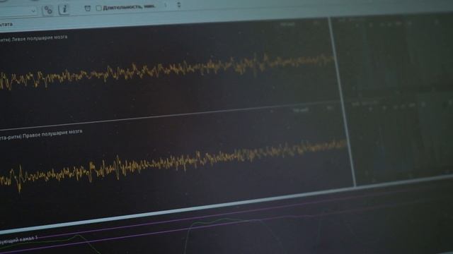 Тренинги БОС в медицинском центре Эра