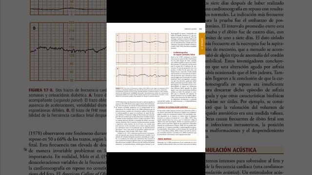 VALORACIÓN PRENATAL смотреть онлайн