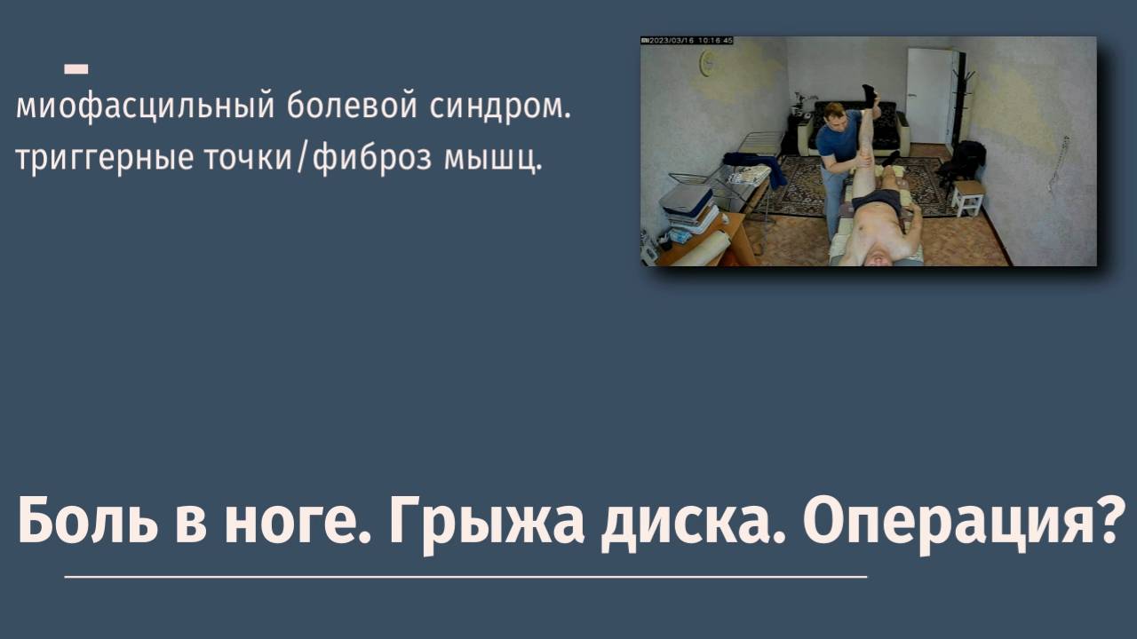Миофасциальный синдром. Боль в ноге. Грыжа диска. Операция?