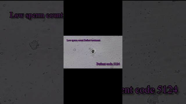 low sperm count treatment смотреть онлайн