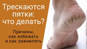 Трескаются пятки: что делать?