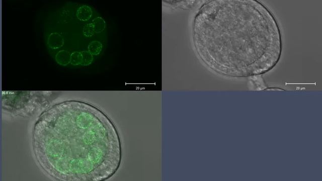 Drosophila melanogaster Nuage dynamics; live image of Vasa-GFP in a stage 3 egg chamber смотреть онлайн
