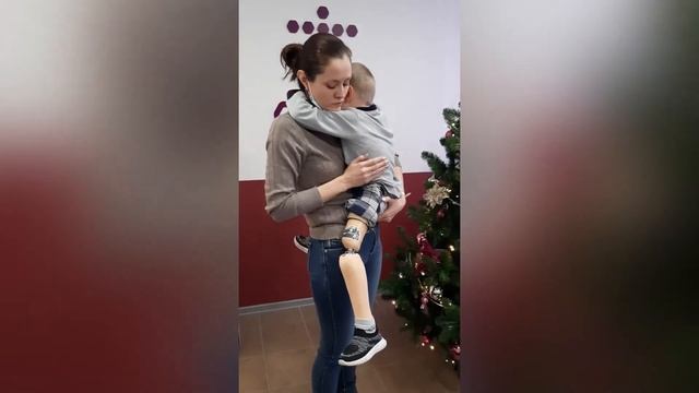 Детское протезирование, протез бедра модульный для нашего активного пациента смотреть онлайн