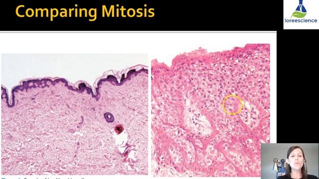 Cancer смотреть онлайн