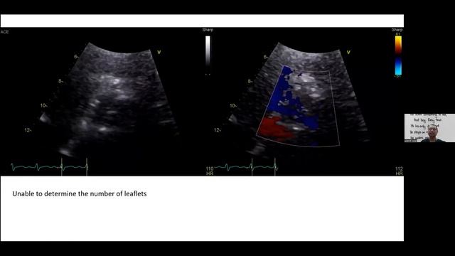 ECHO IN DIAGNOSIS смотреть онлайн