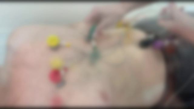 ЭКГ в Клинике семейная смотреть онлайн