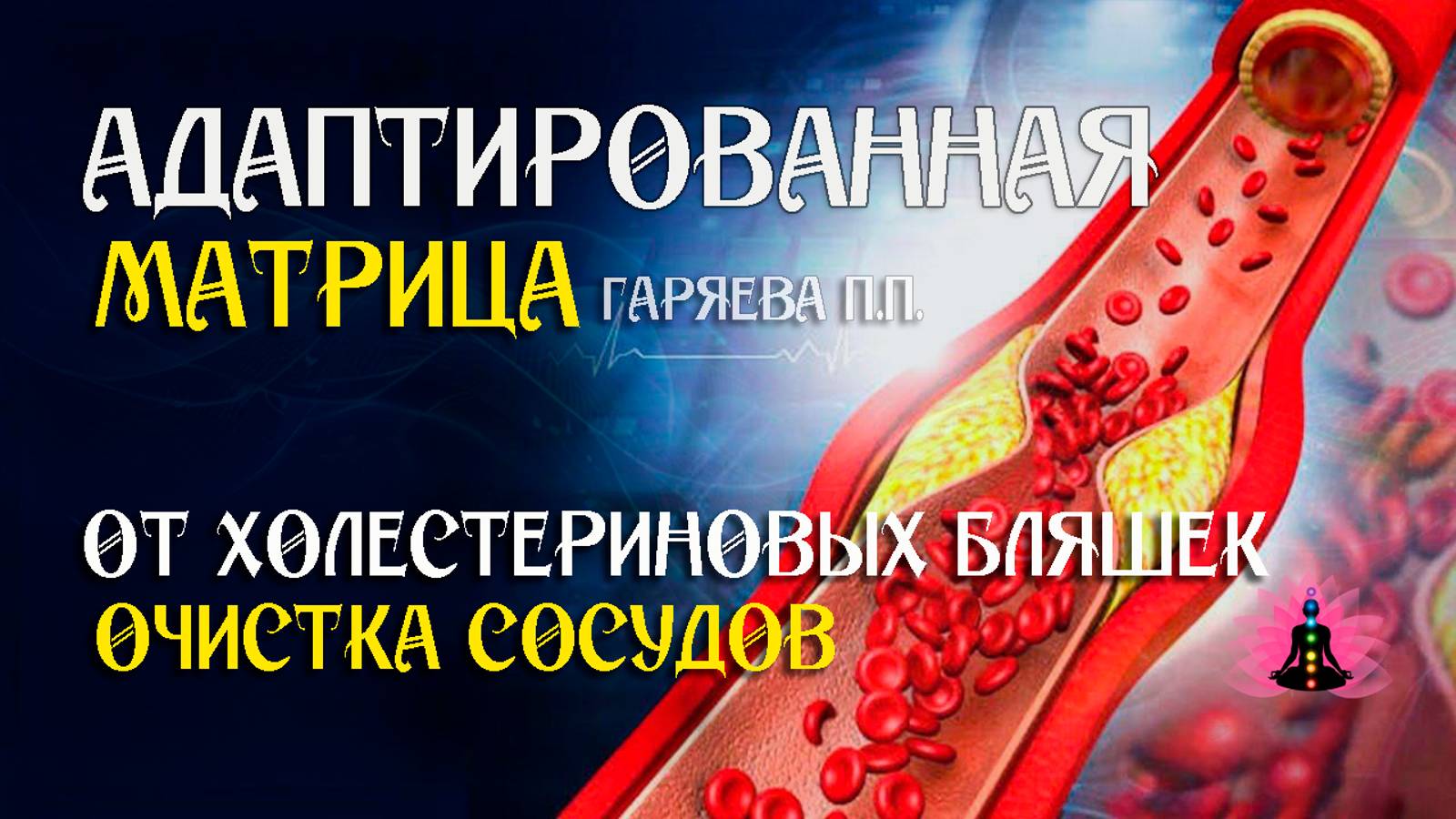 Очистка сосудов от холестериновых бляшек 🌀 Адаптированная программа матрица ☀️ SoftRadio.ru смотреть онлайн