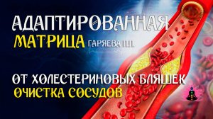 Очистка сосудов от холестериновых бляшек  🌀 Адаптированная программа матрица ☀️ SoftRadio.ru