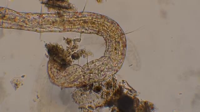 Aeolosoma sp. (Aeolosomatidae) – 3 mm, light microscopic movie/Olajosgiliszta смотреть онлайн
