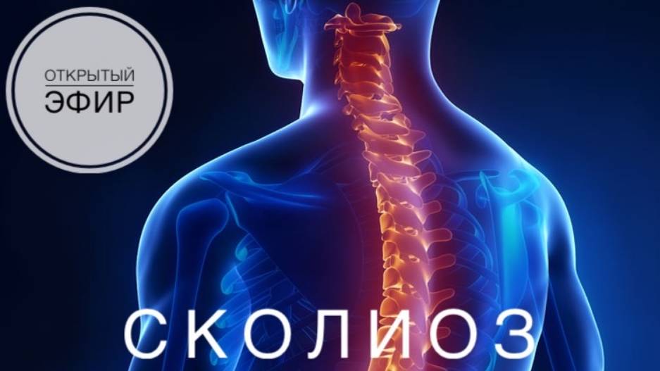 Сколиоз // Открытый эфир от 19.12.2024.