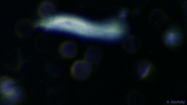 Брюхоресничный червь \\ Gastrotricha смотреть онлайн