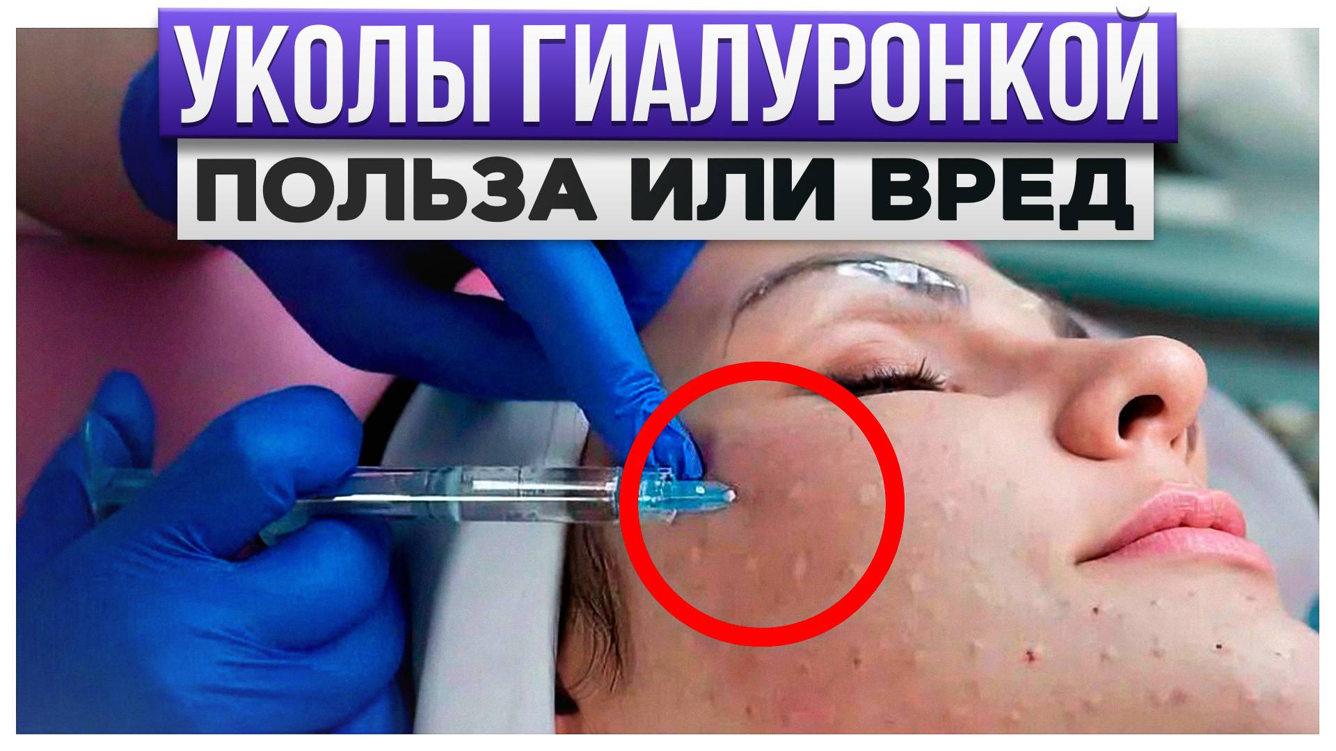 НЕ ДЕЛАЙ такую процедуру, пока не посмотришь ЭТО! / ЧТО такое биоревитализация и КАК она работает?