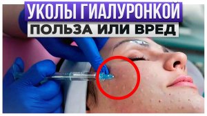 НЕ ДЕЛАЙ такую процедуру, пока не посмотришь ЭТО! / ЧТО такое биоревитализация и КАК она работает?