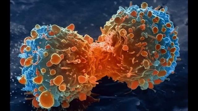 Cancer Mix 5 DH Story By Remove Kebab смотреть онлайн