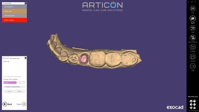 Single Crown Design In 2min(Exocad ChairsideCAD)//Быстрый дизайн коронки в Exocad ChairsideCAD
